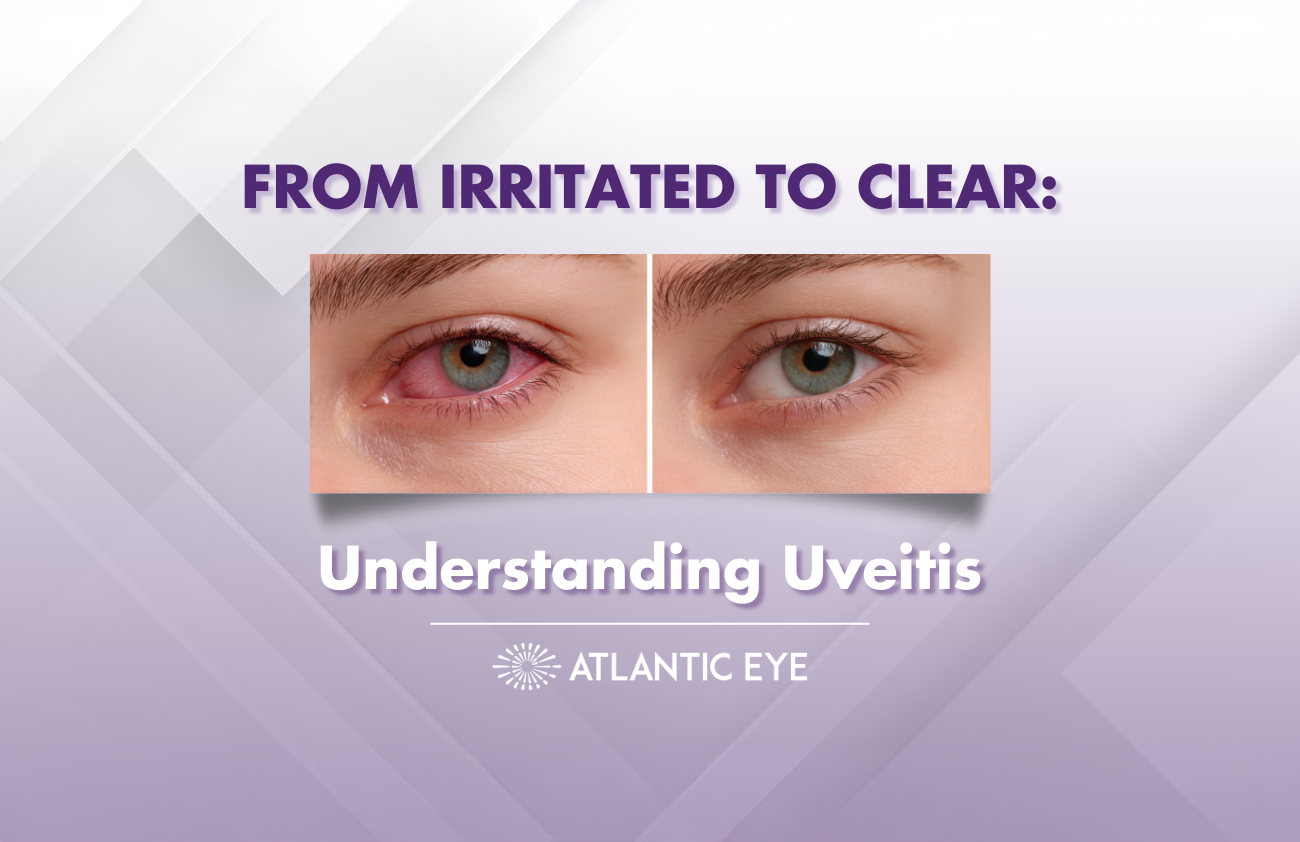 Graphic image comparison of red eyes versus clear eyes