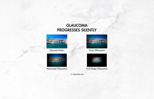 Glaucoma graphic comparison